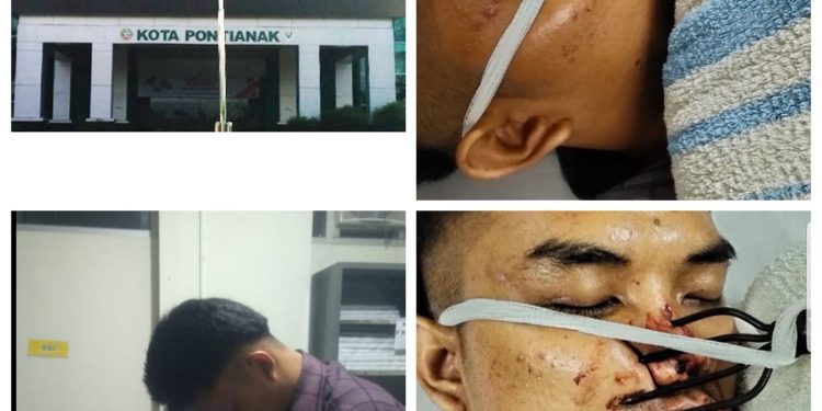 AKPERSI Minta Pemkot Copot Dirut RS Sultan Syarif Mohamad Alkadrie